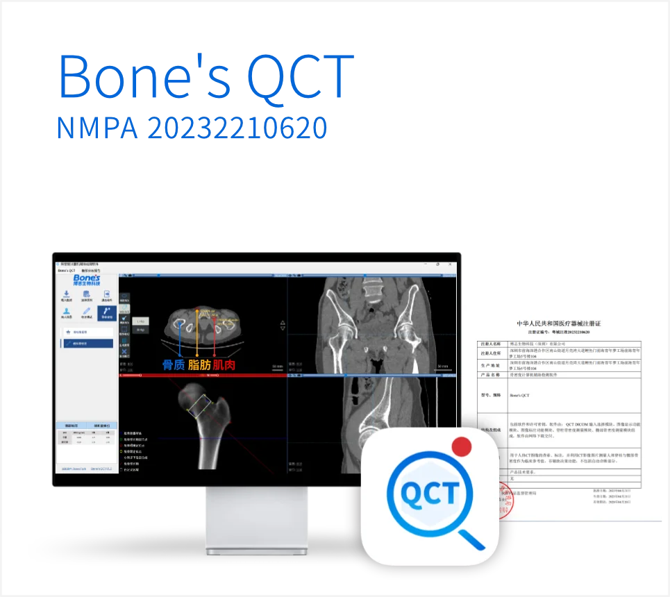Bone's QCT