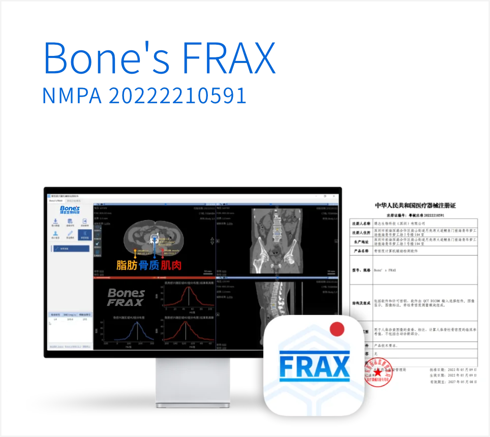 Bone's FRAX