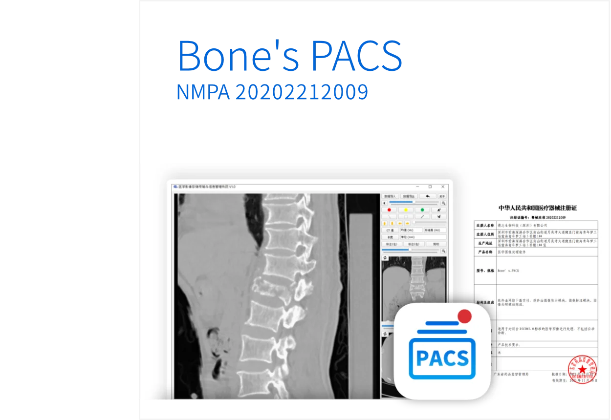 Bone's PACS