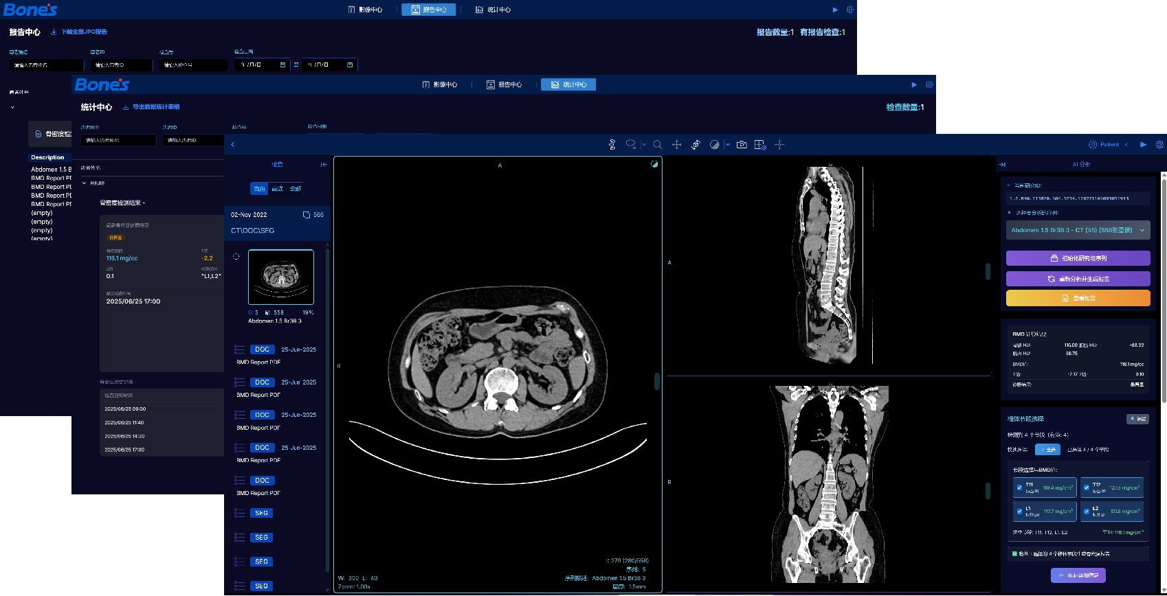 Bone's QCT Web