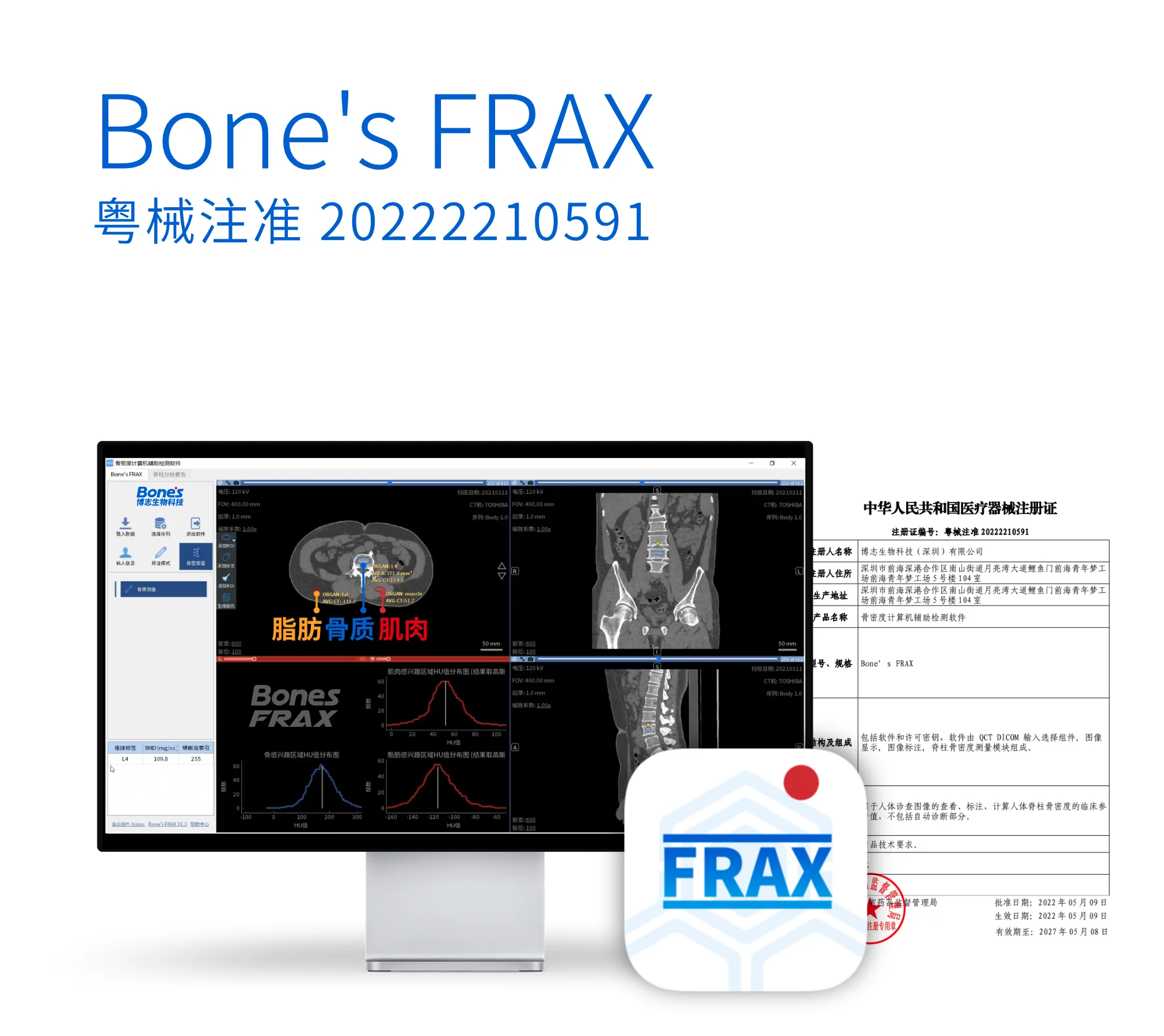 Bone's FRAX