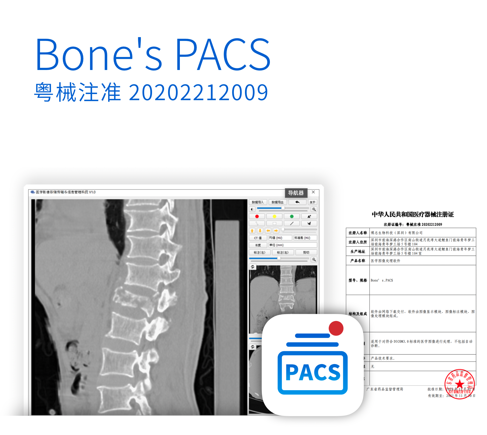 Bone's PACS