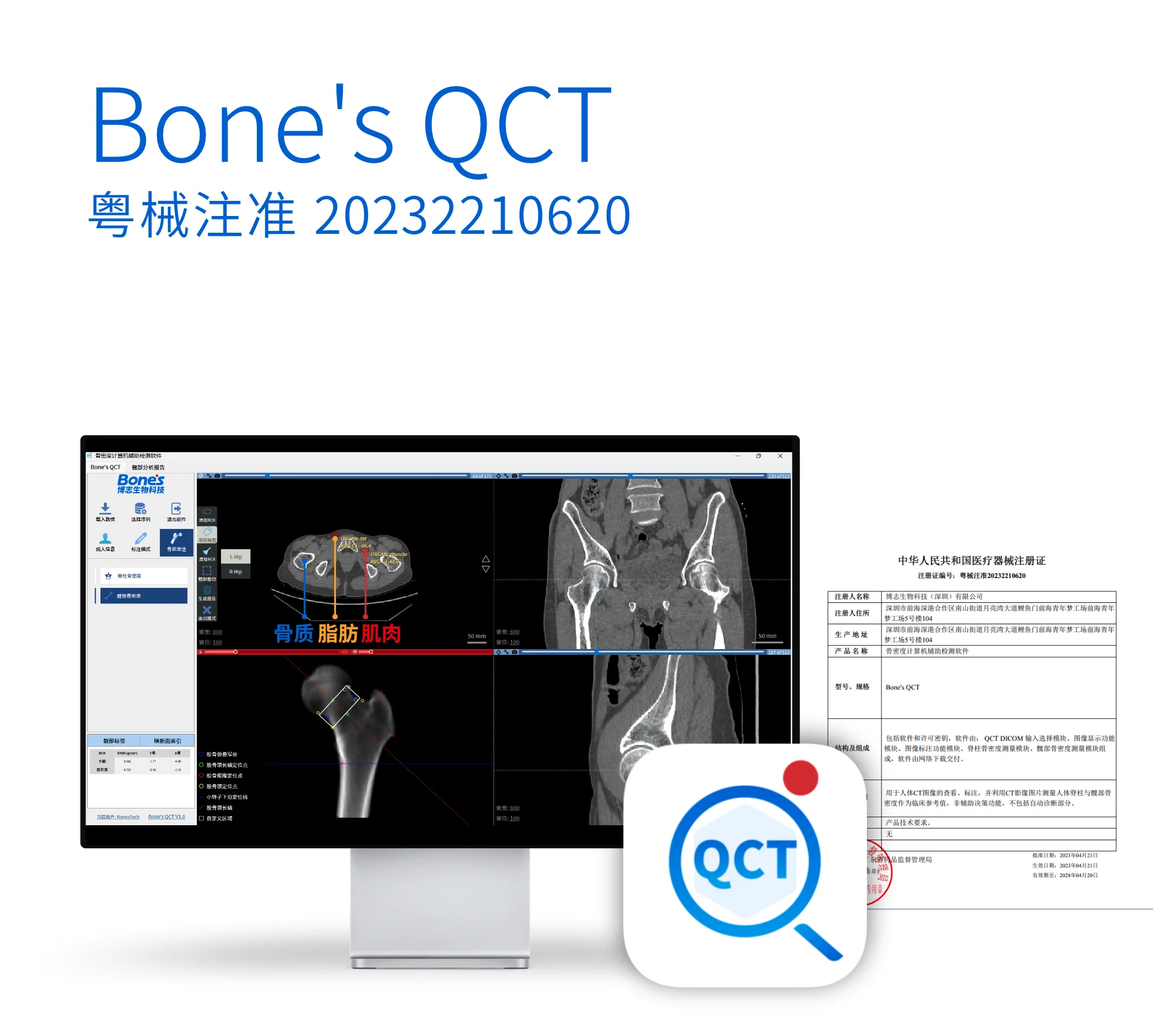 Bone's QCT