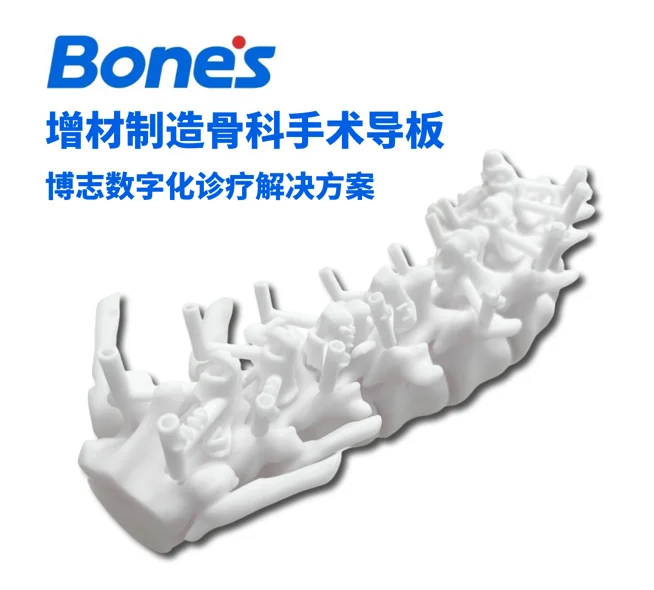 增材制造骨科手术导板